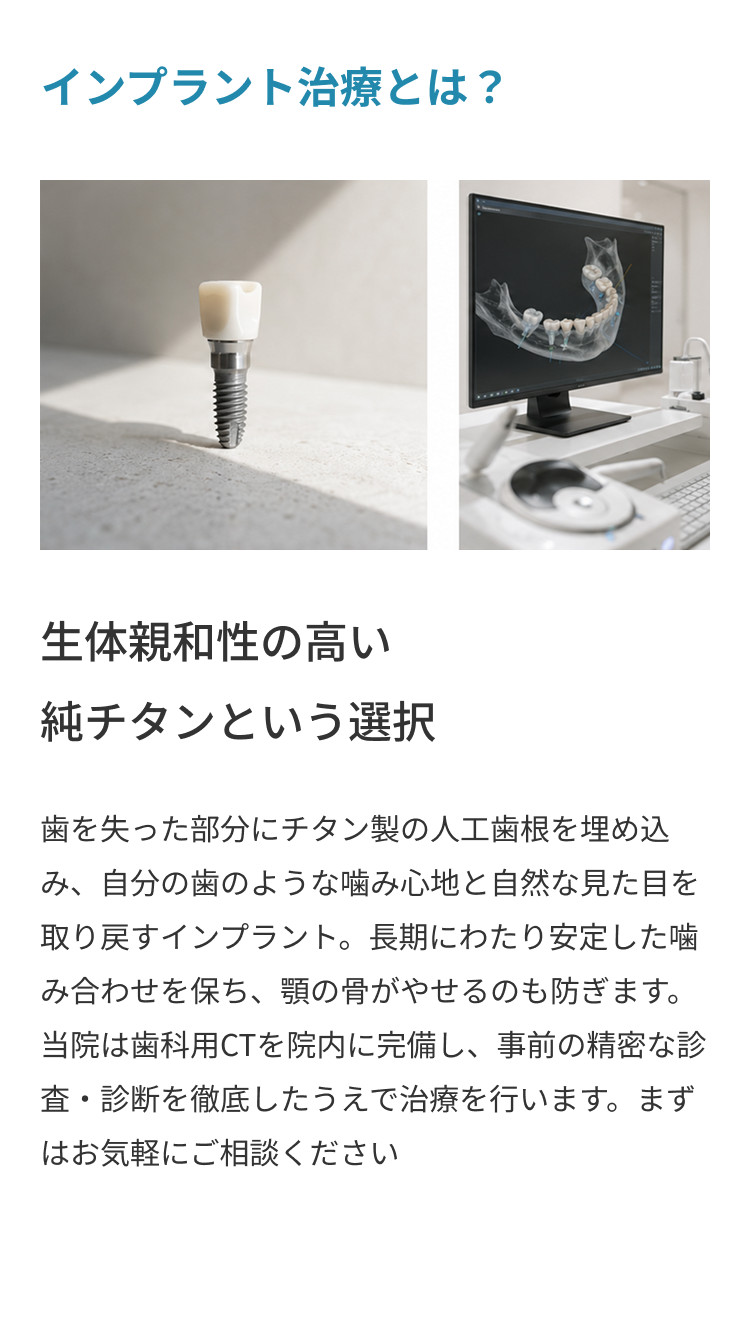 インプラント治療とは？